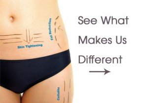 3D Lipo